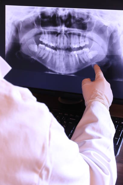 Best Knocked-Out Tooth (Avulsed Tooth) Treatment in East Freehold, NJ
